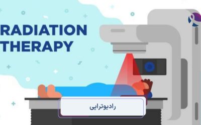 رادیوتراپی