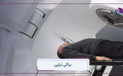 براکی تراپی