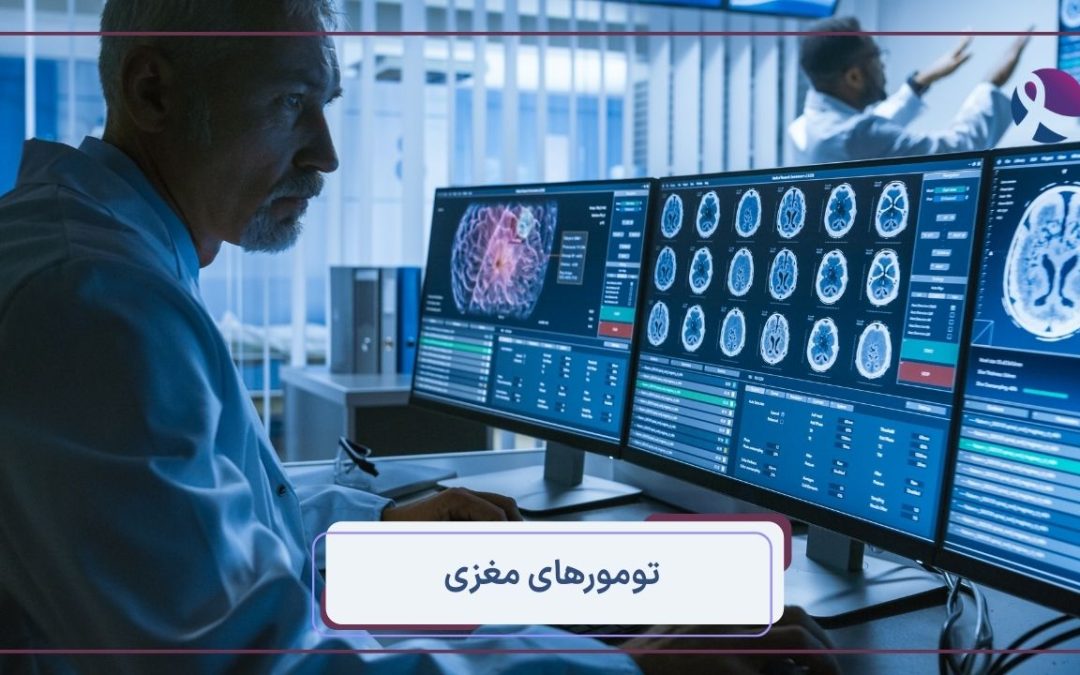 تومورهای مغزی