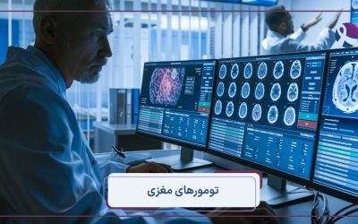 تومورهای مغزی