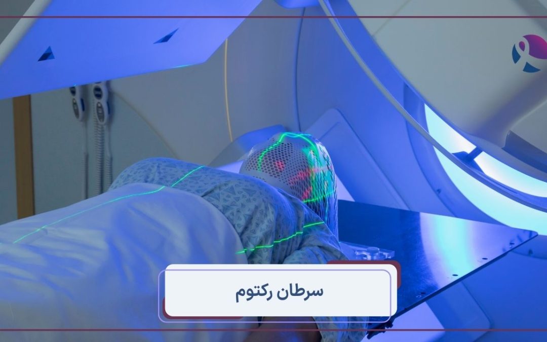 سرطان رکتوم